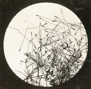 Speckkäfer (Dermestidae), Schutzhaare der Larve. Mikro-Aufnahme