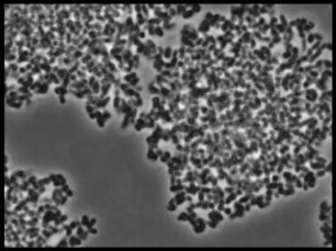 Corynebacterium mirabile (Corynebacteriaceae) - Vermehrung und Koloniebildung