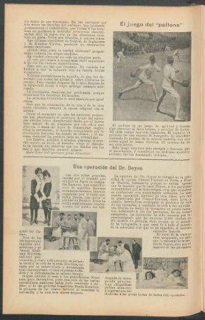 El juego del "pallone"