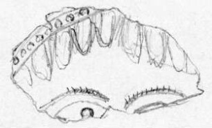 Fragment einer Rosette aus dünnem Blech; nur die mit einem Gorgoneion verzierte Mitte ist erhalten.