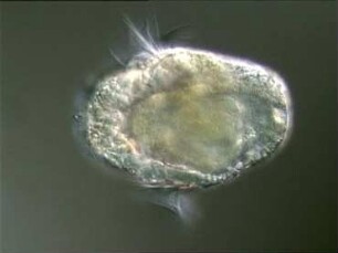 Meeresplankton - Polychaeta (Borstenwürmer)
