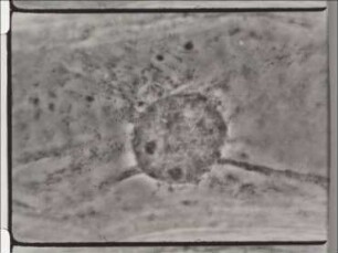 The Organelle of the Living Plant Cell (Allium cepa)