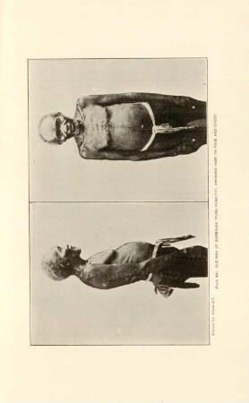 Plate XIII. Old man of Zambales (pure Negrito), showing hair on face and chest