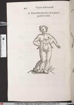 Puer tribus brachij, & totidem pedibus natus.