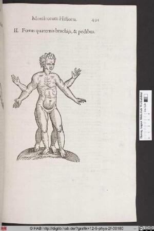 Foetus quaternis brachijs, & pedibus.