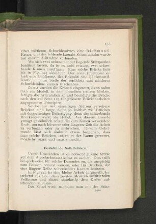 Festsitzende Sattelbrücken.