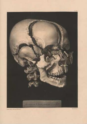 Schädel