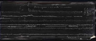 [Graphical recordings: respiration]