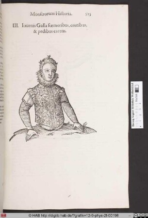 Iuuenis Galla foemoribus, cruribus, & pedibus carens.