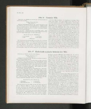 Abb. 16 Gesunde Milz
