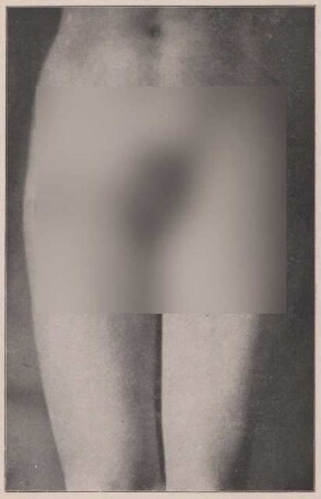 Fotografie, die den 19-jährigen P. zeigt (5)