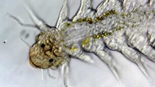 Syllidae, species undet., Lanzarote 2019