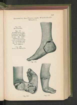 Fig. 136. Hautschnitte.