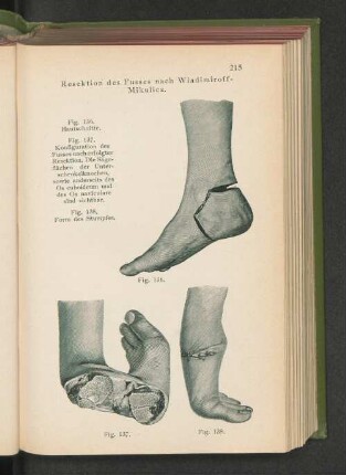 Fig. 136. Hautschnitte.