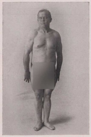 Fotografie, die J. O. unbekleidet zeigt (3)
