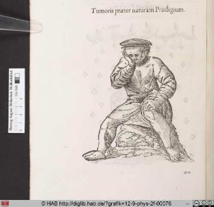 Tumoris praeter naturam Prodigium.
