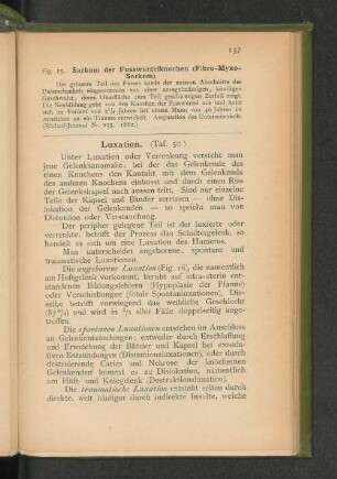 Luxation. (Taf. 50.)