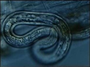 Hydromermis contorta (Nematoda) - Eindringen des Parasiten in den Wirt Chironomus thummi (Diptera)