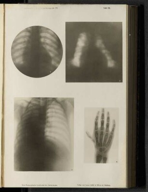 Tafel XII.