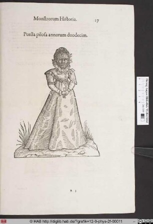 Puella pilosa annorum duodecim