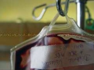 Nahaufnahme einer Bluttransfusion (Prämiertes Foto D)