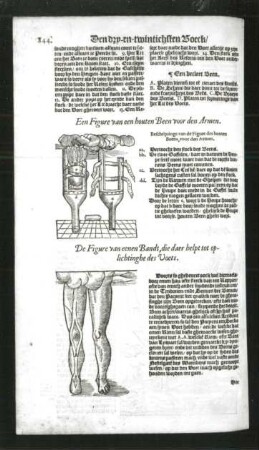 Beinprothese für Arme und Fußstützband. Textsteite mit Holzschnitten von J. Canin, 31,1 x 18,8 cm. Aus: De Chirurgie ende alle de opera ..., Dortrecht, 1592. Dresden, SLUB Chirurg.15.v