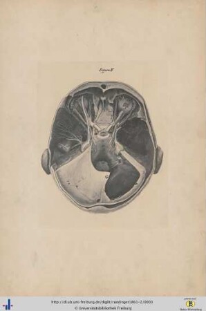 Figura IV.