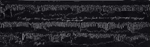 [Graphical recordings: respiration]