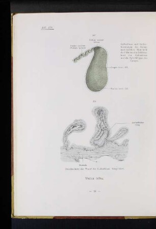 Vesica fellea.