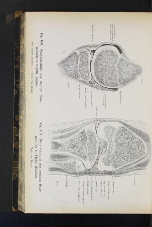 Fig. 109. Sagittalschnitt des rechten Kniegelenks v. 16jähr. Knaben. Figg. 110. Frontalschnitt des rechten Kniegelenks v. 8jähr. Knaben.