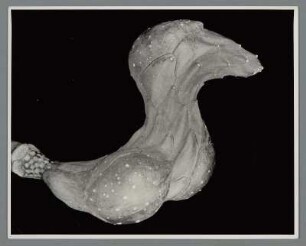 Magnolie, Sammelfrucht (Magnolia x soulangiana)