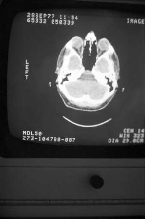 Einsatz der Computertomographie innerhalb der Röntgendiagnostik