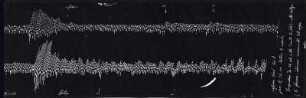 [Graphical recordings: respiration]