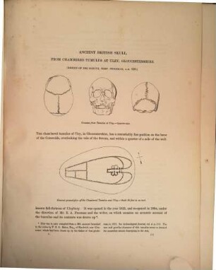 Crania Britannica : Delineations and descriptions of the skulls of the aboriginal and early inhabitants of the British Islands: with notices of their other remains. By Joseph Barnard Davis and John Thurnam. 2