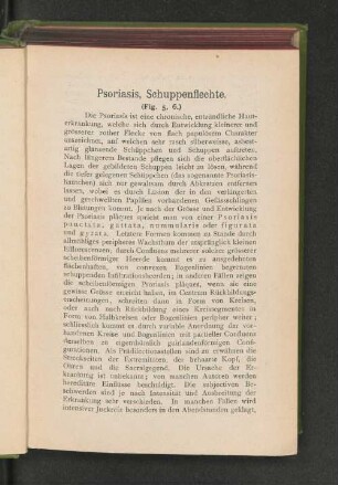 Psoriasis, Schuppenflechte.