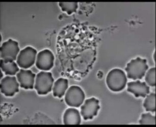 Phagozytose von Kernmaterial im Supravitalpräparat - Genese der "Sjögren-Zelle"