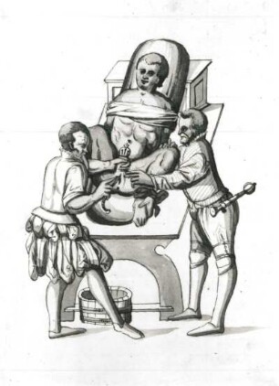 Steinschnitt (Blasensteinoperation eines gefesselten Patienten durch Arzt mit Gehilfen). Zeichnung, getuscht; 18,5 x 13,5 cm. Aus: Bartisch, Georg, Kunstbuch darinnen ist der ganze gründliche Bericht des Blasensteins, Dresden, 1575. Dresden, SLUB Mscr.Dresd.C.291