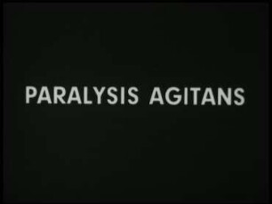 Paralysis agitans