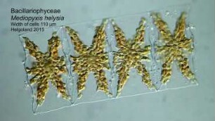 Mediopyxis helysia Helgoland 2015