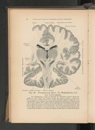 Fig. 65. Frontalschnitt durch die Hemisphären und den Gehirnstamm.