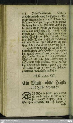Observatio XCI. Ein Mann ohne Hände und Füsse gebohren