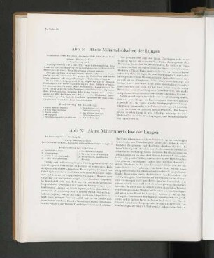 Abb. 51 Akute Miliartuberkulose der Lungen