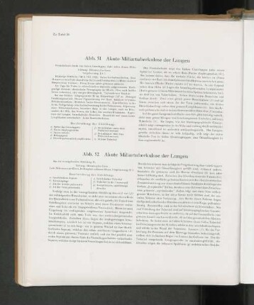 Abb. 51 Akute Miliartuberkulose der Lungen