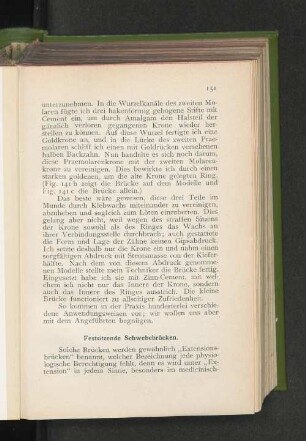 Festsitzende Schwebebrücken.