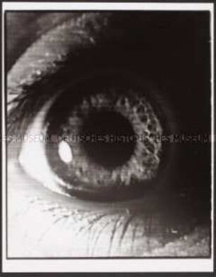 Auge (Altersgruppe 14-17)