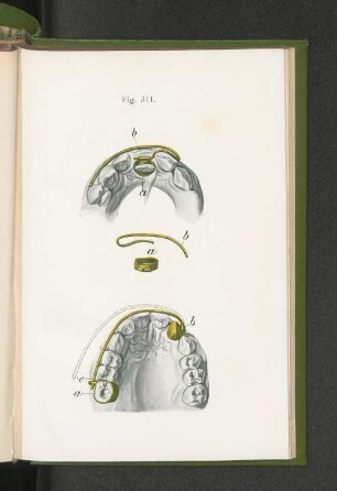 Fig. 311.