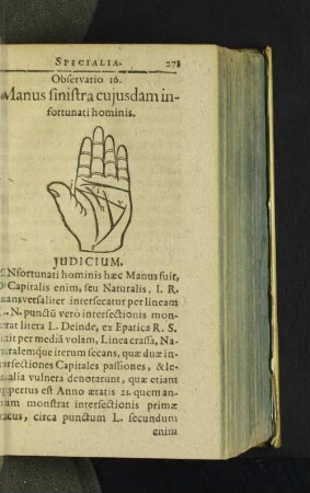 Observatio 16. Manus sinistra cujusdam infortunati hominis.