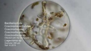 Coscinodiscus sp. with Lagenisma sp. Sylt 2015