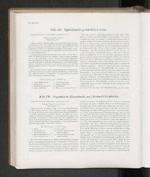 Abb. 129 Epididymitis gonorrhoica acuta