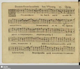 25. Amen dico vobis